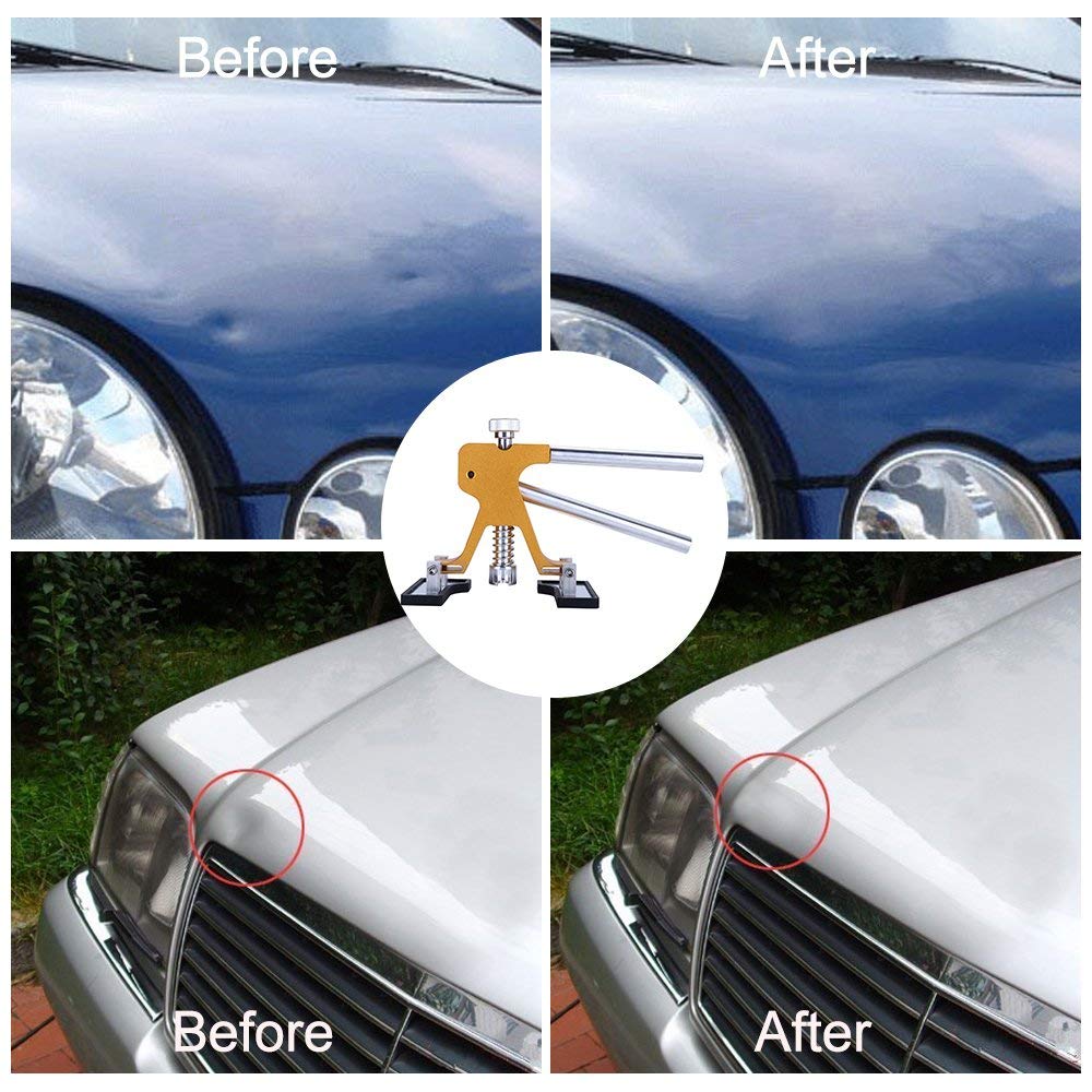 Auto Dent Puller Kits,Adjustable Golden Dent Remover Tools Paintless Dent Repair Kit Dent Lifter Puller for Car Large & Small Ding Hail Dent Removal